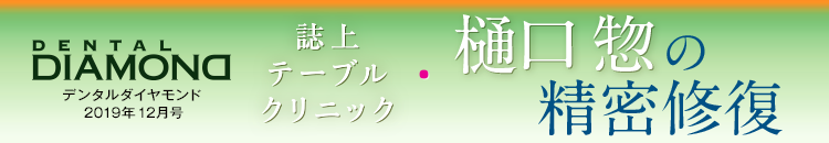 デンタルダイヤモンド 2019年12月号 誌上テーブルクリニック　樋口 惣 の精密修復