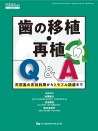 歯の移植・再植Q&A 天然歯の有効利用からトラブル回避まで