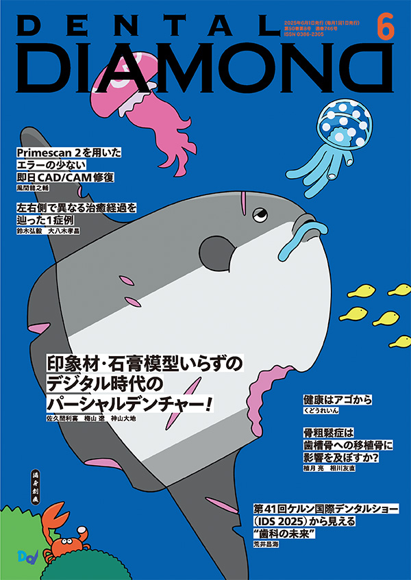 月刊デンタルダイヤモンド6月号 表紙