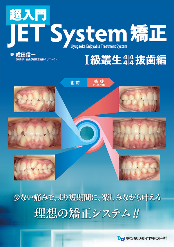【10月の新刊】超入門 JET System矯正 Ⅰ級叢生4444抜歯編