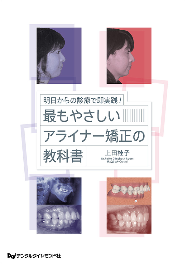 【3月の新刊】明日からの診療で即実践！ 最もやさしいアライナー矯正の教科書