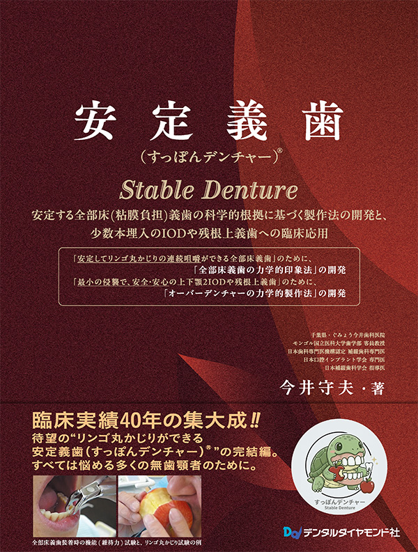 【予約販売：4月24日以降発送予定】【5月の新刊】安定義歯(すっぽんデンチャー)(R)　安定する全部床（粘膜負担）義歯の科学的根拠に基づく製作法の開発と、少数本埋入のIODや残根上義歯への臨床応用