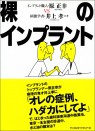 裸のインプラント