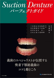 Suction Denture パーフェクトガイド 歯科総合出版社 デンタルダイヤモンド社