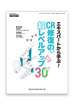 デンタルダイヤモンド増刊号　『エキスパートから学ぶ！　CR修復の超レベルアップ30』