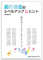 歯内療法のレベルアップ＆ヒント