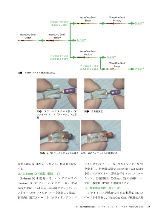 器材・薬剤からみる歯内療法のすぐれモノ