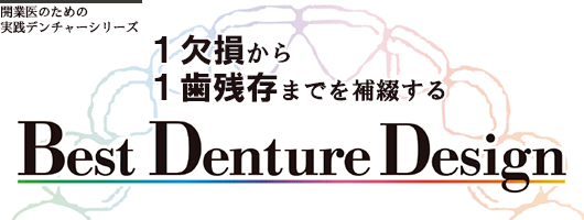 １歯欠損から１歯残存までを補綴する Best Denture Design