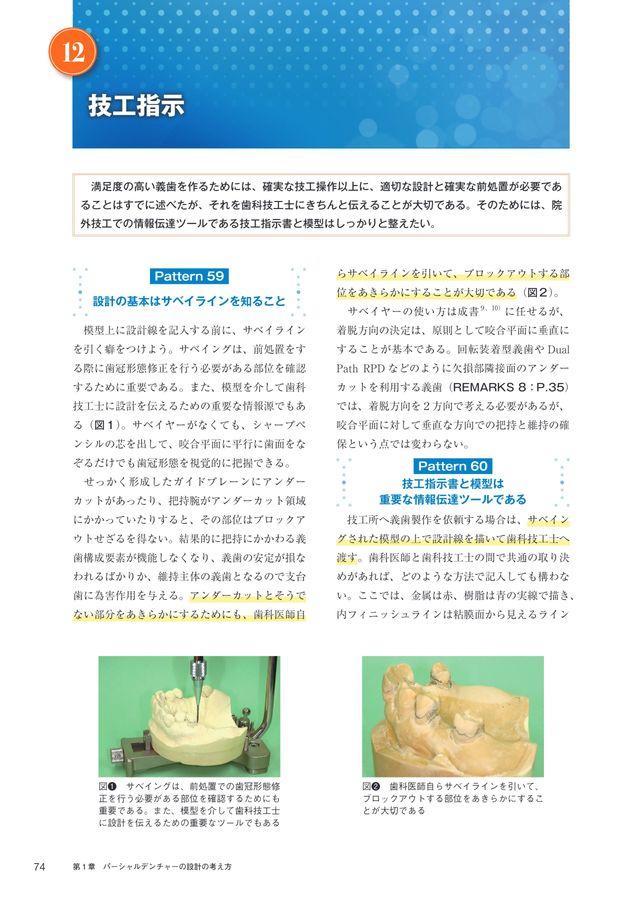 1歯欠損から1歯残存までを補綴する Best Denture Design 【増補改訂版】