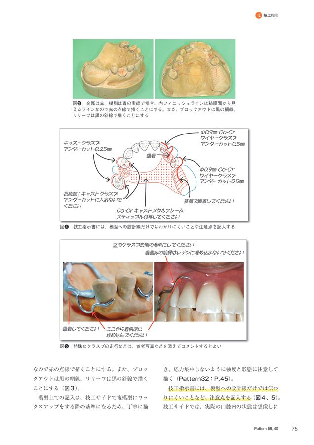 1歯欠損から1歯残存までを補綴する Best Denture Design 【増補改訂版】