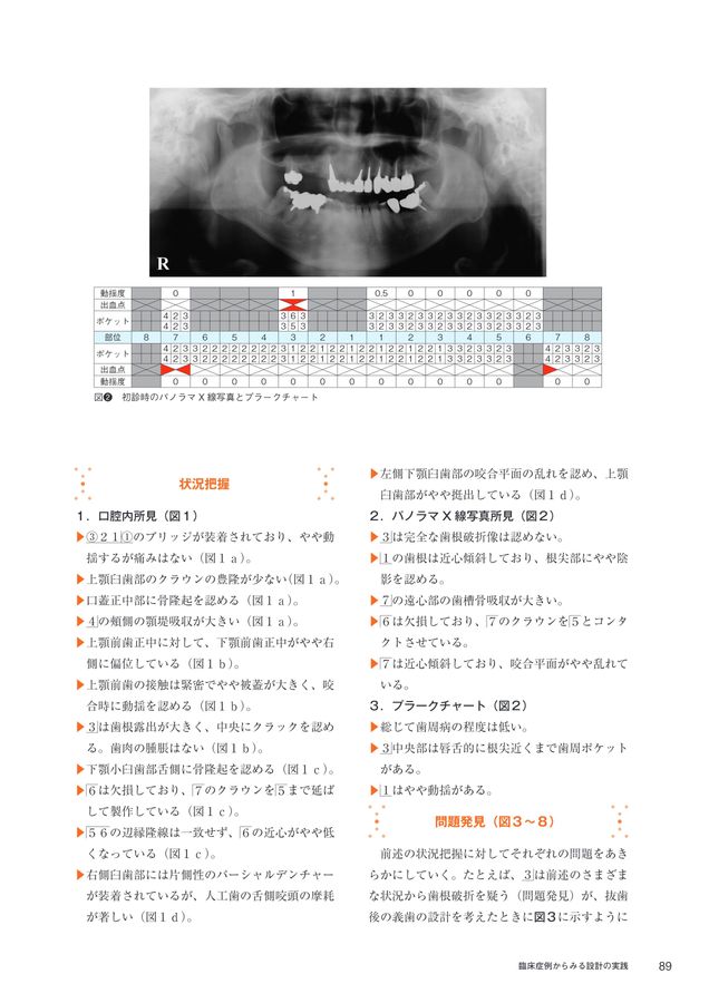 Denture Best Design 1歯欠損から1歯残存までを補綴する 増補改訂版 1
