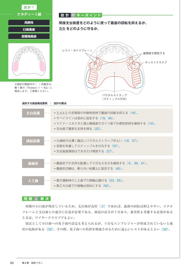 1歯欠損から1歯残存までを補綴する Best Denture Design 【増補改訂版】