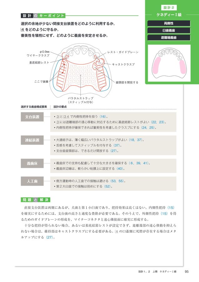 1歯欠損から1歯残存までを補綴する Best Denture Design 【増補改訂版】