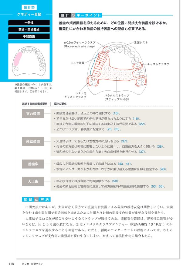 1歯欠損から1歯残存までを補綴する Best Denture Design 【増補改訂版】