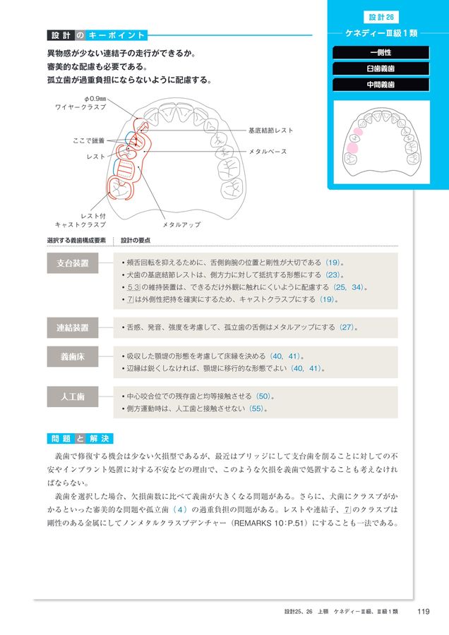 1歯欠損から1歯残存までを補綴する Best Denture Design 【増補改訂版】