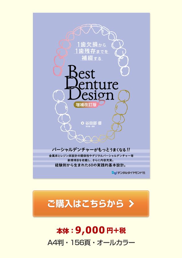 1歯欠損から1歯残存までを補綴する Best Denture Design 【増補改訂版】