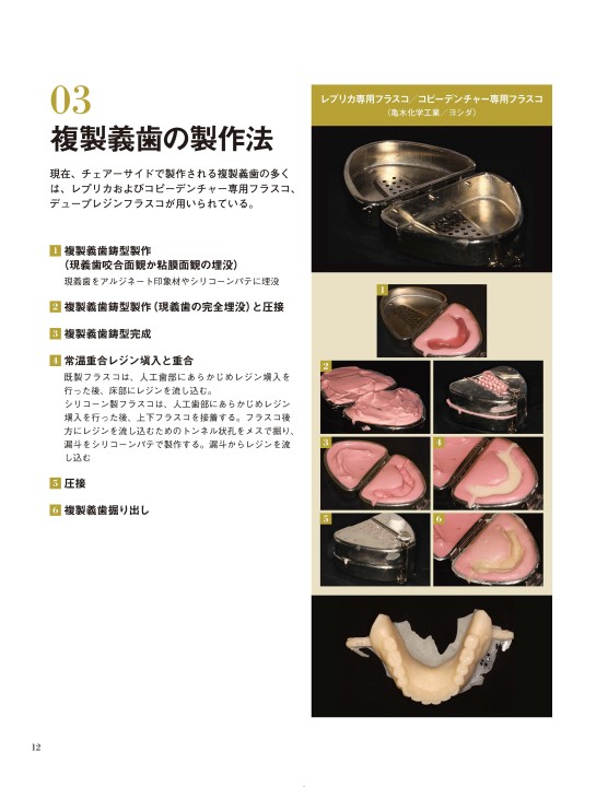 コピーデンチャーズ 複製義歯の製作とその活用法 | 書評