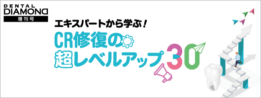 エキスパートから学ぶ！　CR修復の超レベルアップ30