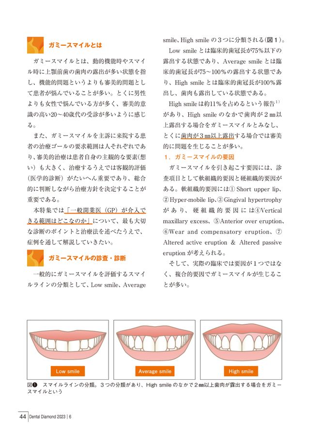 デンタルダイヤモンド 2023年6月号