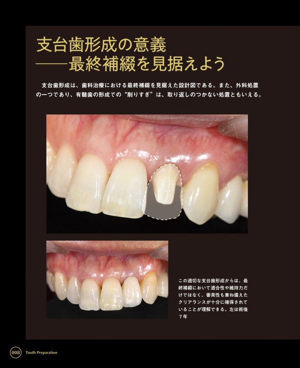 Dd Basics 01 Tooth Preparation 支台歯形成 試し読み 歯科総合出版社 デンタルダイヤモンド社