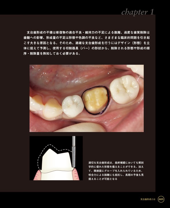 Tooth Preparation[支台歯形成] (DD Basics 1) 書籍詳細「DD Basics 01 Tooth Preparation ［支台歯形成