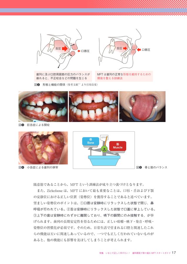 総合口腔診断学 マイクロレトロチップ（逆根充用チップ） | 白水貿易株式会社