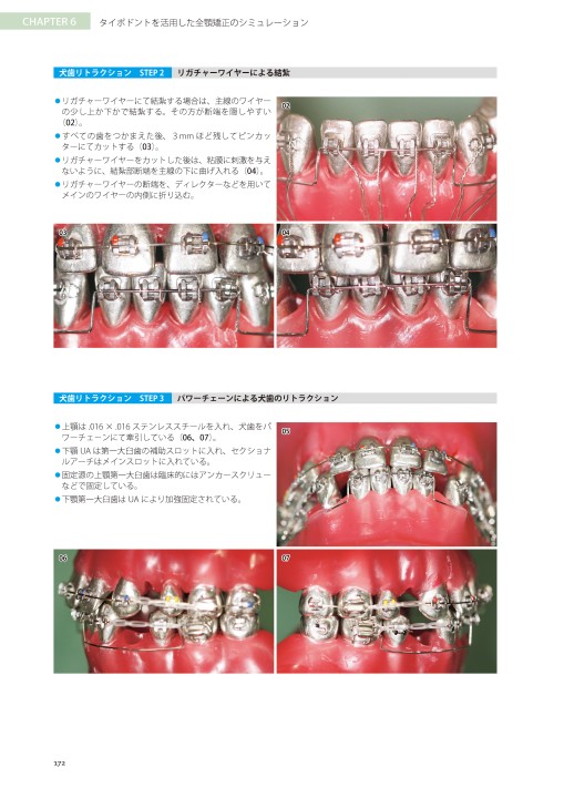 藤本研修会 Standard Textbook 3 Limited Orthodontic Treatment（LOT）