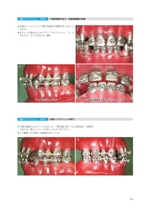 藤本研修会 Standard Textbook 3 Limited Orthodontic Treatment（LOT）