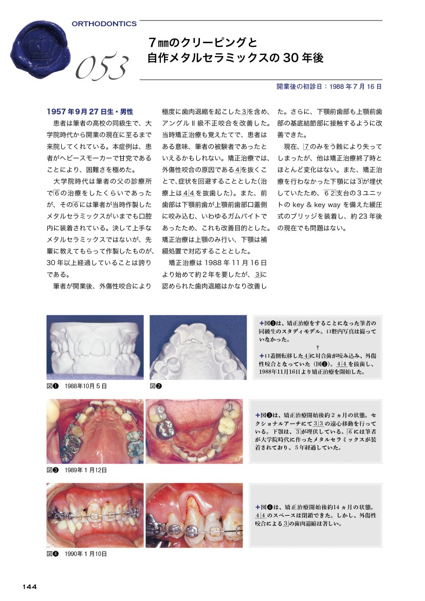 行田克則の臨床アーカイブ 補綴メインの長期100症例