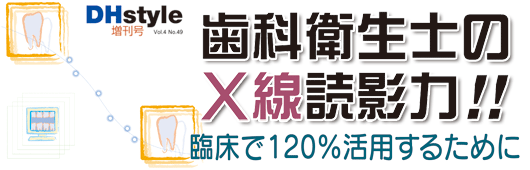 歯科衛生士のX線読影力!! 臨床で120%活用するために