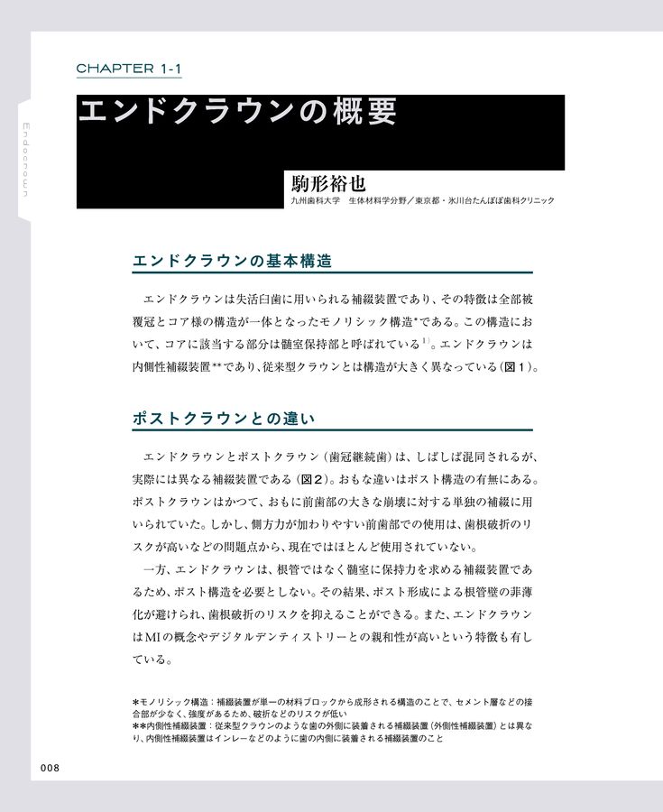 エンドクラウン 理論と実践を徹底解説