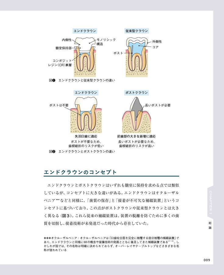 エンドクラウン 理論と実践を徹底解説