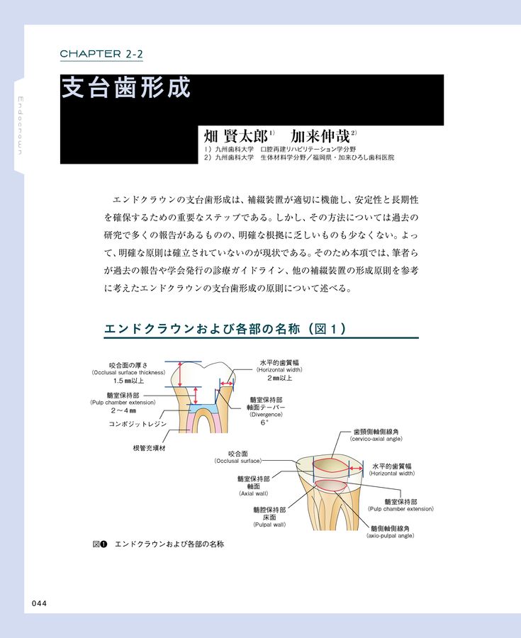 エンドクラウン 理論と実践を徹底解説
