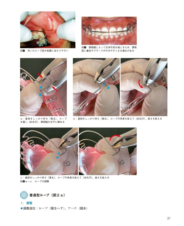 GPのための床整正・矯正のすすめ GPのための床矯正・矯正のすすめ| 歯科総合出版社 デンタルダイヤモンド社