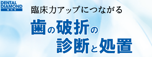 臨床力アップにつながる 歯の破折の診断と処置