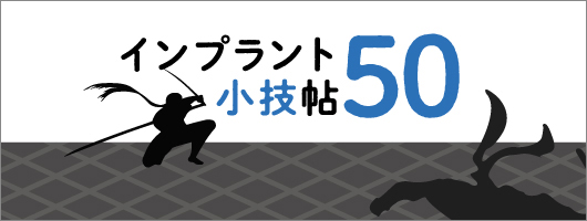 インプラント小技帖50