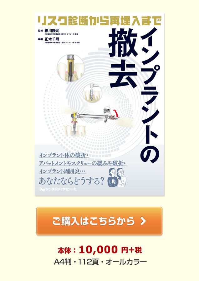 インプラントの撤去　～リスク診断から再埋入まで～ 本のエッセンス｜刊行にあたって：インプラントの撤去 ～リスク