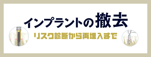 インプラントの撤去　～リスク診断から再埋入まで～