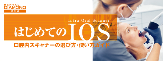 はじめてのIOS 口腔内スキャナーの選び方・使い方ガイド