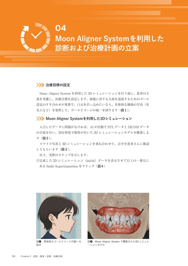 超入門 JET System矯正 Ⅰ級叢生4444抜歯編