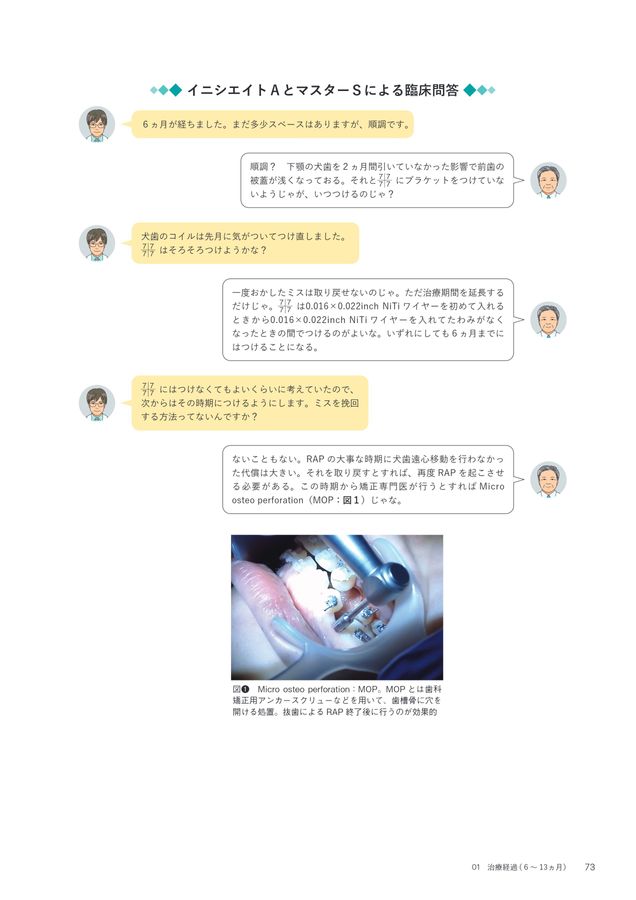 超入門 JET System矯正 Ⅰ級叢生4444抜歯編