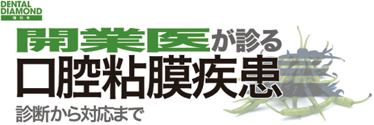 開業医が診る口腔粘膜疾患 診断から対応まで