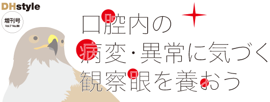 口腔内の病変・異常に気づく観察眼を養おう