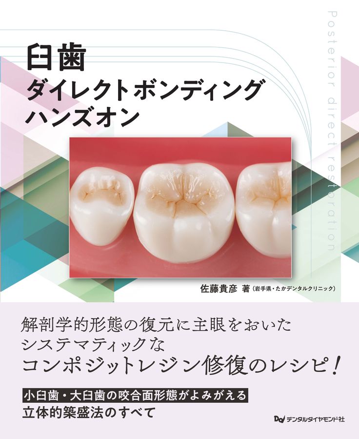 臼歯ダイレクトボンディング ハンズオン