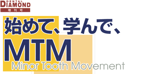 始めて、学んで、MTM　Minor Tooth Movement