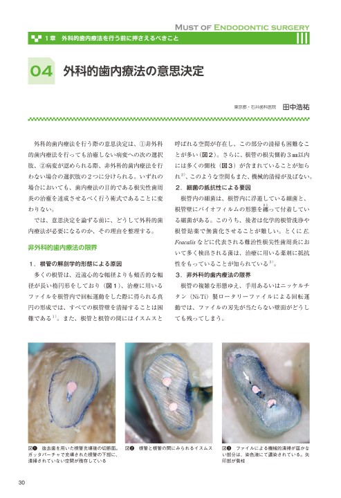 マストオブ・エンドドンティックサージェリー