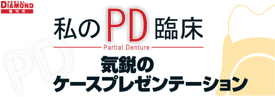 （増刊号）私のパーシャルデンチャー臨床 気鋭のケースプレゼンテーション