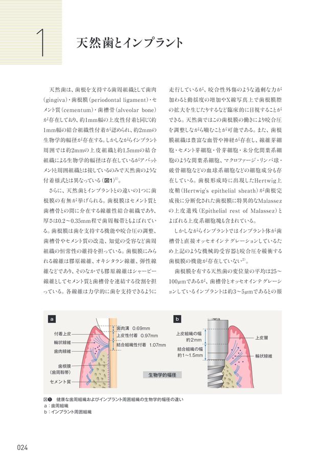 インプラント周囲疾患 診断・予防・対処法