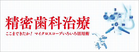 精密歯科治療　ここまできたか！マイクロスコープいろいろ活用術