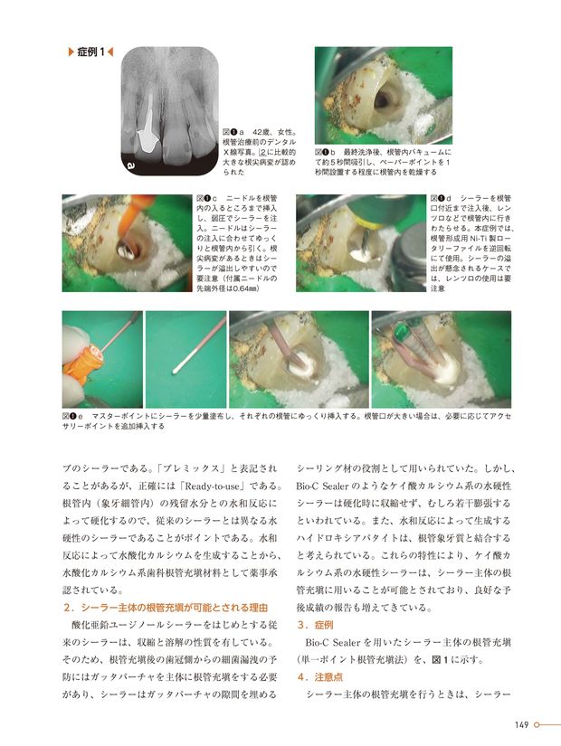 歯内療法の三種の神器2023-2024